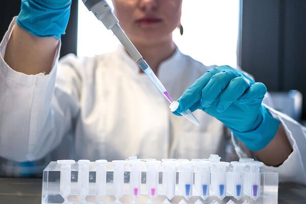 student in the lab with pippet (c) Julia Koblitz unsplash